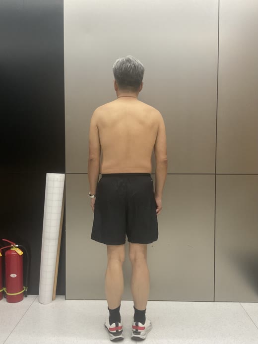 背面照片