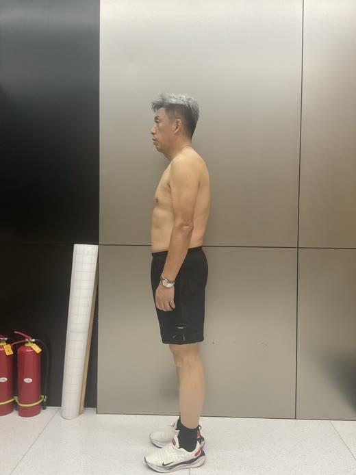 左侧面照片